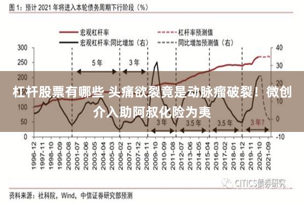 杠杆股票有哪些 头痛欲裂竟是动脉瘤破裂！微创介入助阿叔化险为夷